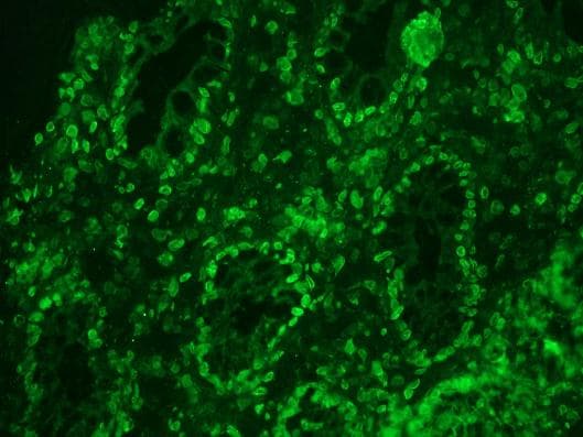 PathPlus™ LMNA / Lamin A+C Antibody (clone 133A2)
