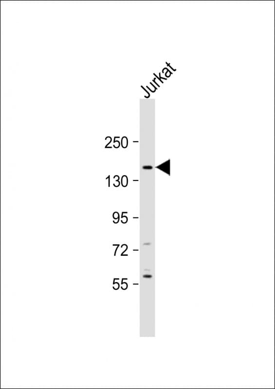 Polyclonal Rabbit anti-Human ADGRA2 / GPR124 Antibody (aa1259-1293, WB)