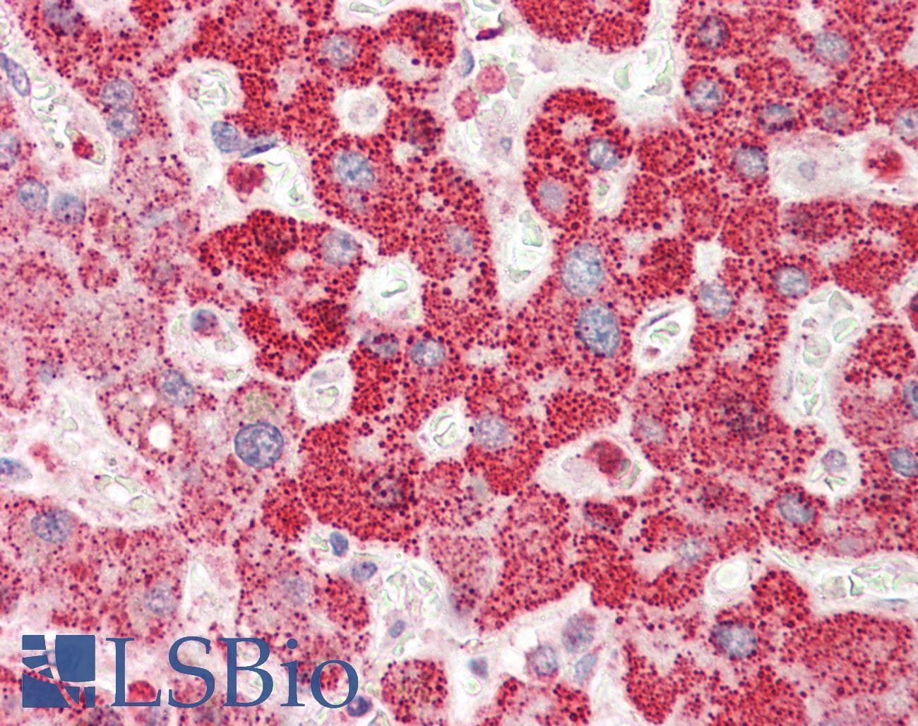 RBM38 Antibody (aa41-90)