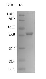 Mouse CMPK / CMPK1 Protein (Recombinant 6His-SUMO, N-terminus)