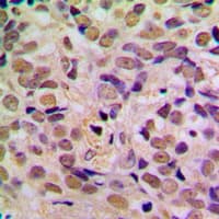 Polyclonal Rabbit anti-Human p14ARF / CDKN2A Antibody (Internal, IHC, IF, WB)