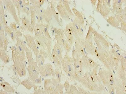 KCNH7 / ERG3 Antibody