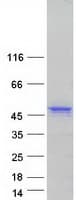 Human DCX / Doublecortin Protein (Recombinant Myc-DDK (Flag))