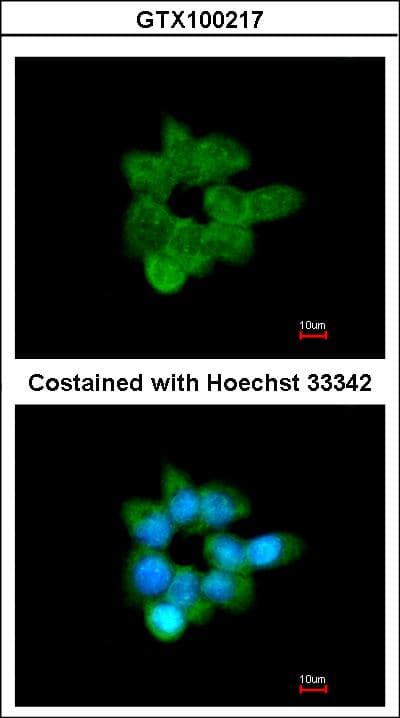 GOB5 / CLCA1 Antibody (aa542-633)