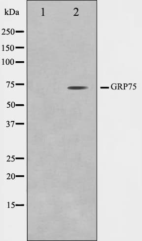 HSPA9 / Mortalin / GRP75 Antibody
