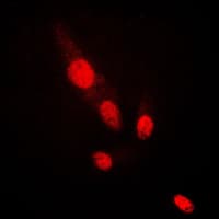 AKT2 Antibody (C-Terminus)