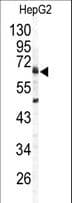ARSB / Arylsulfatase B Antibody (aa464-493)