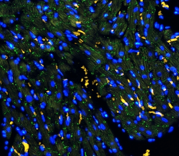 GJA1 / CX43 / Connexin 43 Antibody (aa366-382)