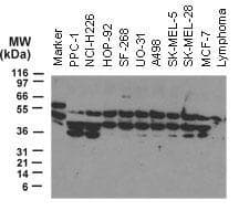 Polyclonal Rabbit anti-Human NOD2 / CARD15 Antibody (IHC, WB)