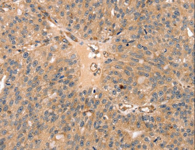Polyclonal Rabbit anti-Human SSX2IP Antibody (IHC)