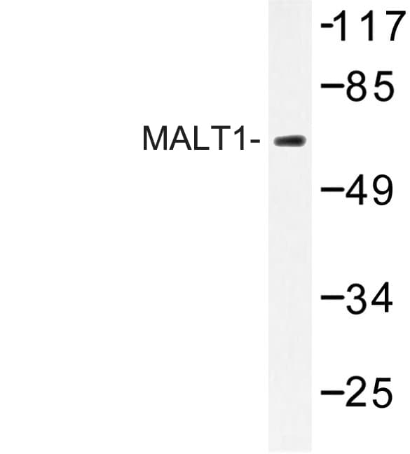 MALT1 Antibody (Asn324)