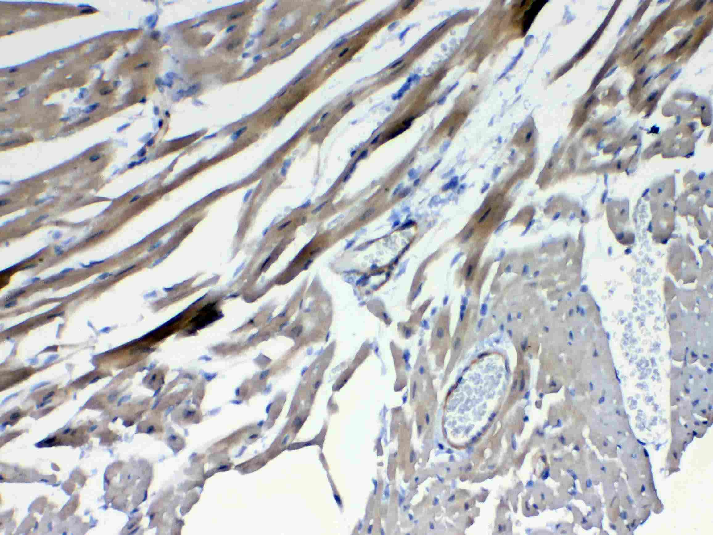 FZD4 / Frizzled 4 Antibody