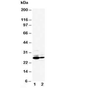 CRP / C-Reactive Protein Antibody (aa209-224)
