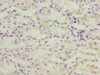 TMEM71 Antibody