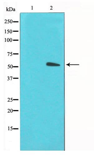 SLC2A3 / GLUT3 Antibody