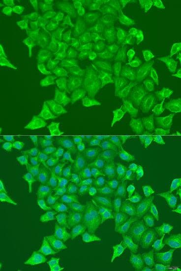 BST2 Antibody