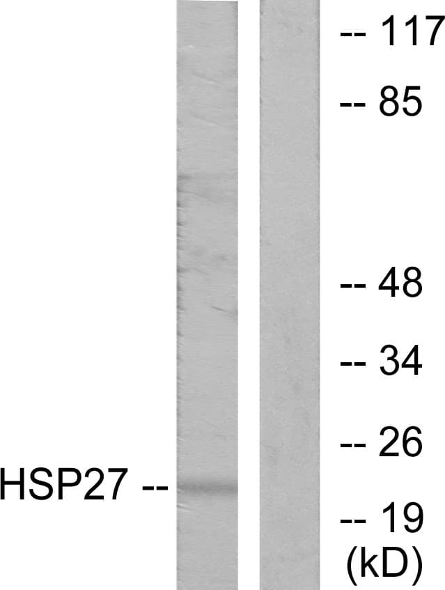 Polyclonal Rabbit anti-Human HSPB1 / HSP27 Antibody (aa5-54, IHC, WB)