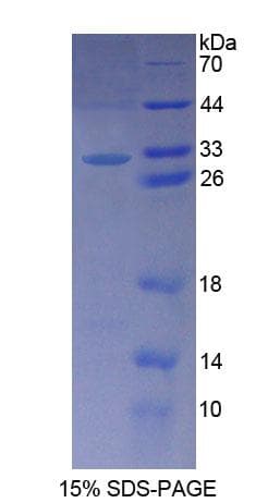 Human PALLD / Palladin Protein (Recombinant His-T7)