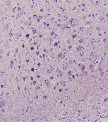 Polyclonal Rabbit anti-Human ENO2 / NSE Antibody (IHC, WB)