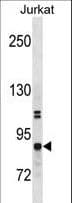 Polyclonal Rabbit anti-Human CHUK / IKKA / IKK Alpha Antibody (aa84-112, WB)
