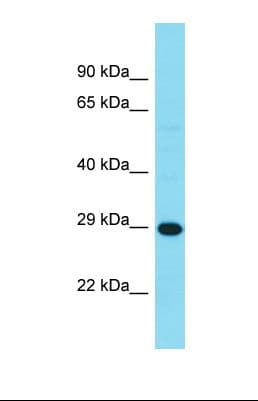 Polyclonal Rabbit anti-Human HDHD3 Antibody (C-Terminus, WB)