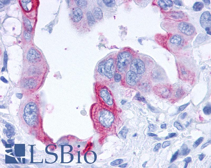 PathPlus™ Polyclonal Rabbit anti-Human GPBAR1 / TGR5 Antibody (C-Terminus, IHC)
