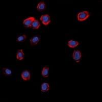 GRIA1 / GLUR1 Antibody (C-Terminus)