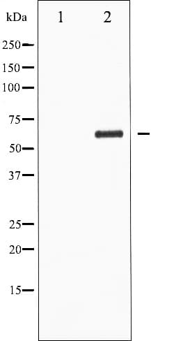 CDC25C Antibody (phospho-Ser216)