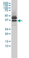 IHC-plus™ Monoclonal Mouse anti-Human JAM2 Antibody (clone 1G4, IHC, WB)