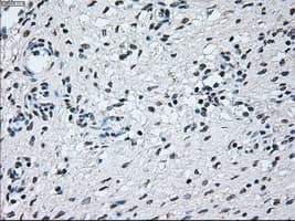 BRAF / B-Raf Antibody (clone OTI3B12)