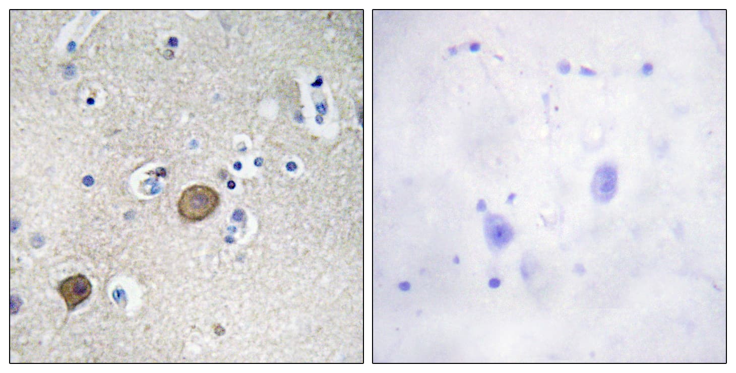 Polyclonal Rabbit anti-Human CTNNA1 / Catenin Alpha-1 Antibody (aa607-656, IHC)