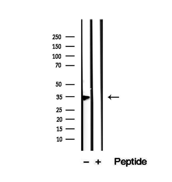 BCAP / PHF11 Antibody