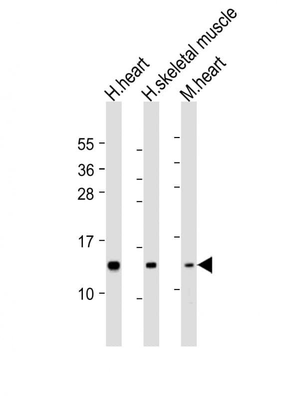 NDUFS6 Antibody (aa32-65)
