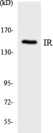 INSR / Insulin Receptor Antibody (aa1306-1355)