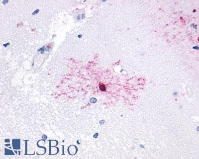 PathPlus™ Polyclonal Rabbit anti-Human CXCR3 Antibody (C-Terminus, IHC)