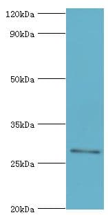 ABH2 / ALKBH2 Antibody (aa1-261)
