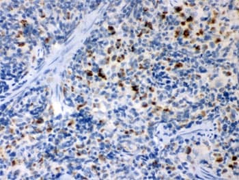 TNFRSF1B / TNFR2 Antibody