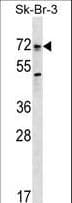 IHC-plus™ ALK3 / BMPR1A Antibody (aa170-197)
