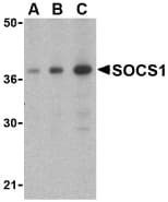 IHC-plus™ Polyclonal Rabbit anti-Human SOCS1 Antibody (IHC, WB)