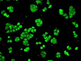 CRYAB / Alpha B Crystallin Antibody (clone OTI3E3, Carrier-free)