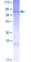Human PAX2 Protein (Recombinant GST)
