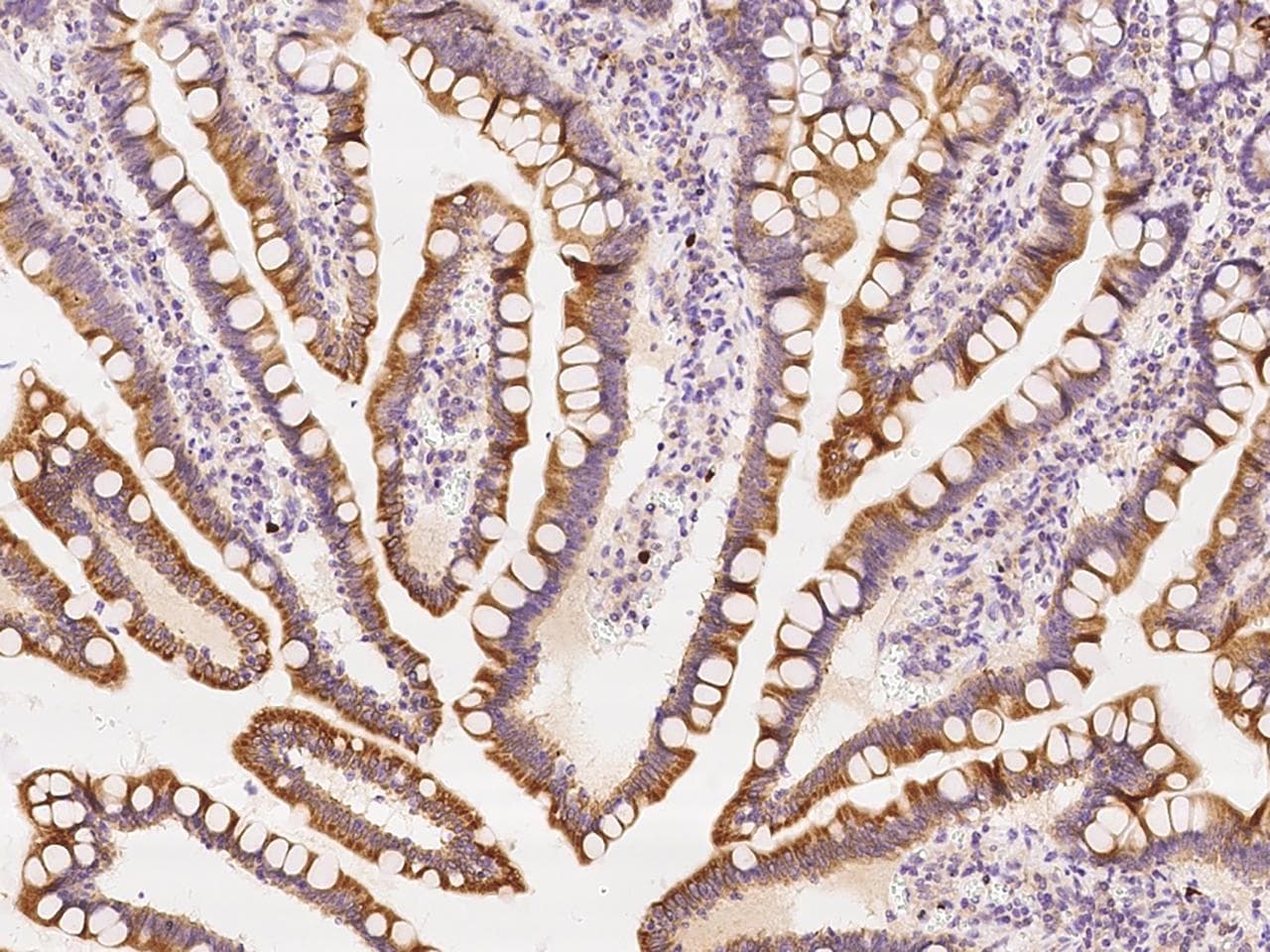 ZCCHC9 Antibody