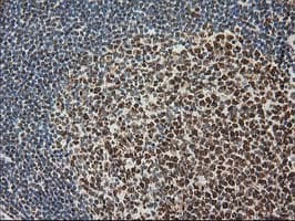 LOX / Lysyl Oxidase Antibody (clone OTI9G2)