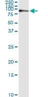 KIF2C / MCAK Antibody (clone 1G2)