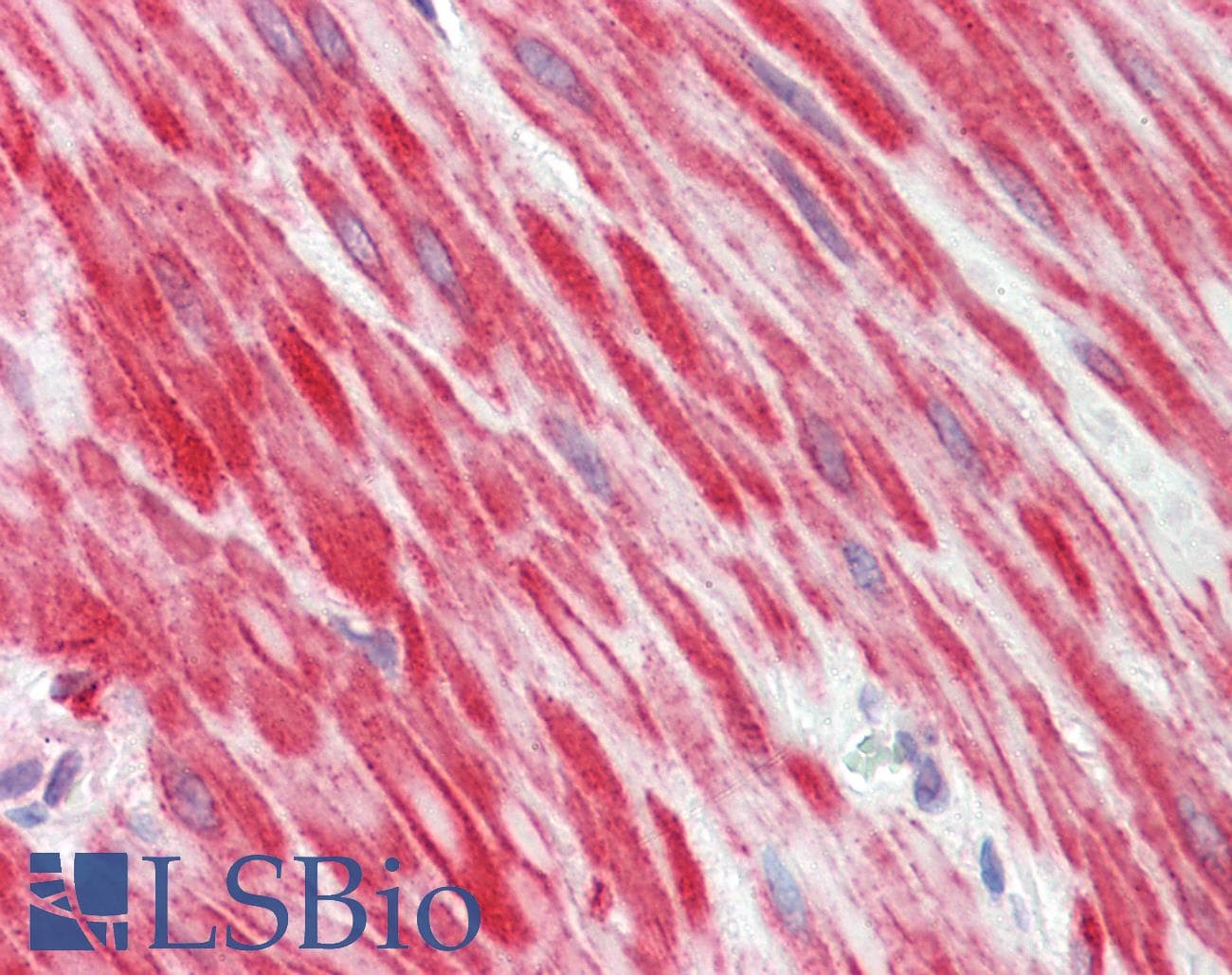 IHC-plus™ MYOD / MYOD1 Antibody (aa211-240)