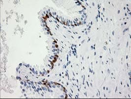 Monoclonal Mouse anti-Human 15-PGDH / HPGD Antibody (clone OTI2F5, IHC, WB)