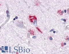 PathPlus™ Polyclonal Rabbit anti-Human DUSP26 / MKP8 Antibody (Internal, IHC)