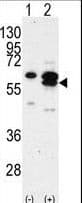Polyclonal Rabbit anti-Human CAMK1G / CaMKI gamma Antibody (aa420-450, IHC, WB)