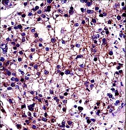 RHOC Antibody (aa102-130)