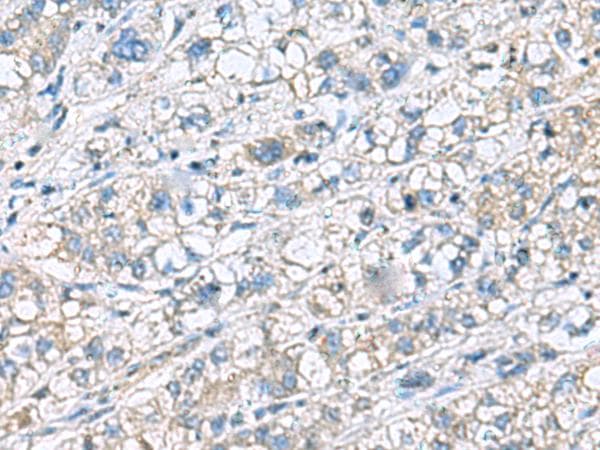 KRCC1 Antibody
